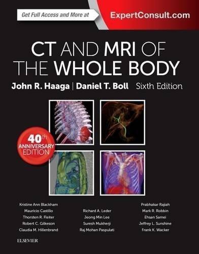 Haaga CT and MRI of whole body Vol